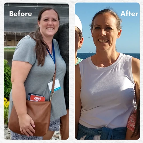 Testimonial Before And After Of A Happy Patient